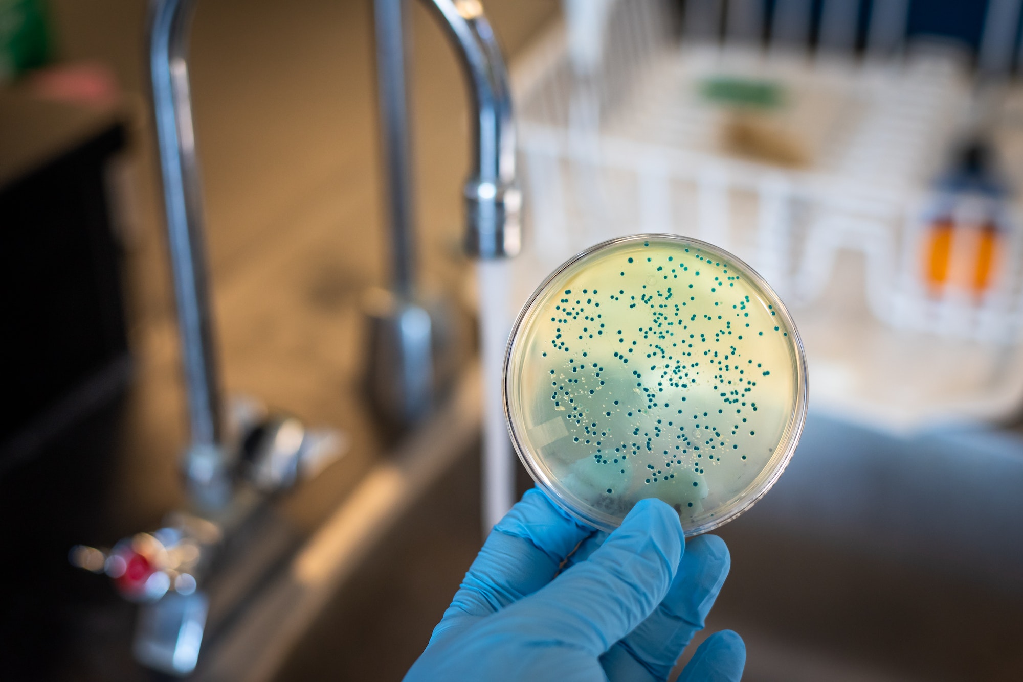 Water contamination with E. coli